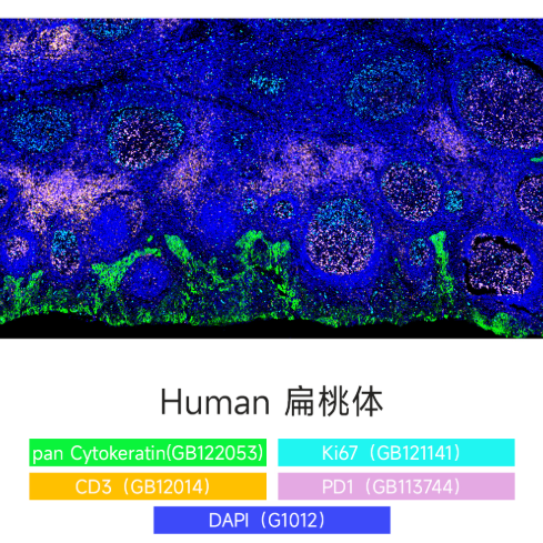 Набор для многоцветного флуоресцентного окрашивания с 4 метками и 5 цветами TSAPLus, Servicebio, Китай