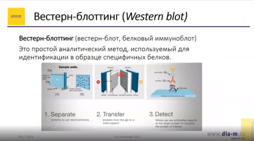 Вестерн-блоттинг (Western blot) Вестерн-блоттинг (Western blot)
