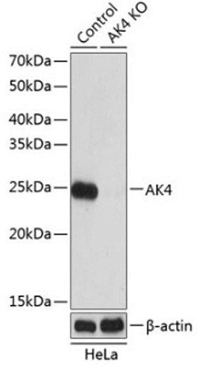 Антитела [KO Validated] AK4 кроличьи, поликлональные