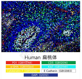 Набор для многоцветного флуоресцентного окрашивания с 6 метками и 7 цветами TSAPLus, Servicebio, Китай
